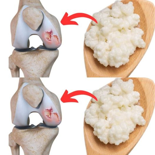 Food for the Renewal of Knee Cartilage: The Benefits of Kefir