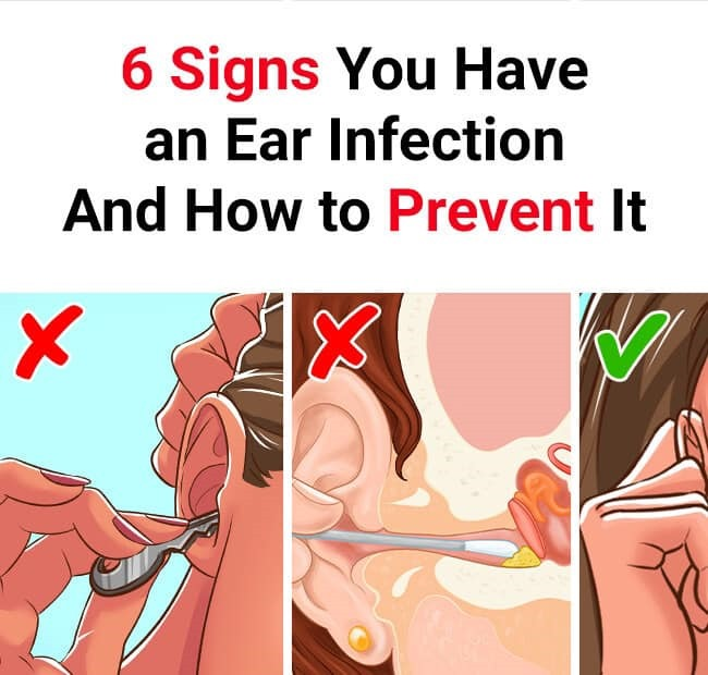 6 Signs You Have an Ear Infection and How to Prevent It