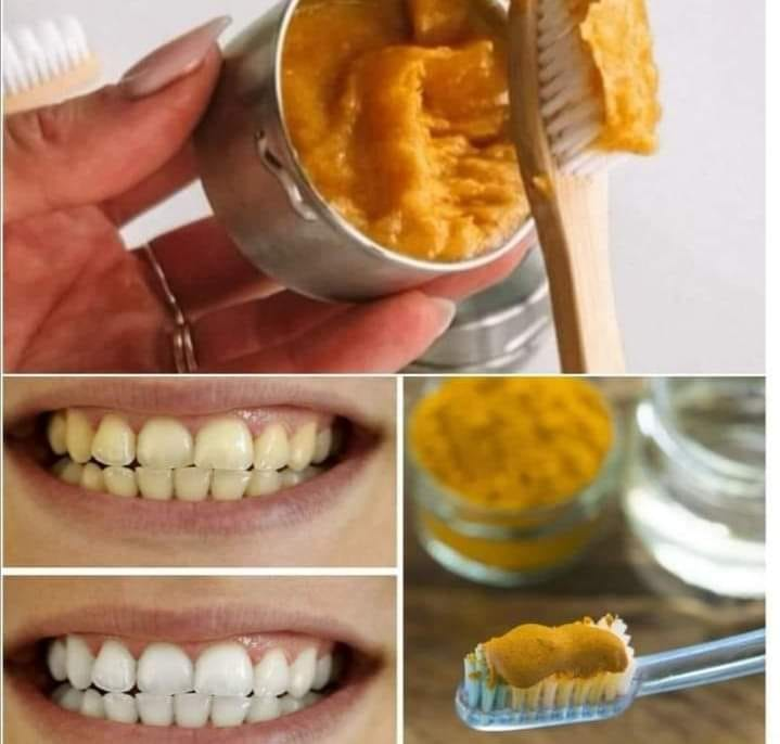 Discover the Natural Wonder of Turmeric for Dental Health