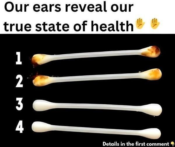 Our ears reveal our true state of health