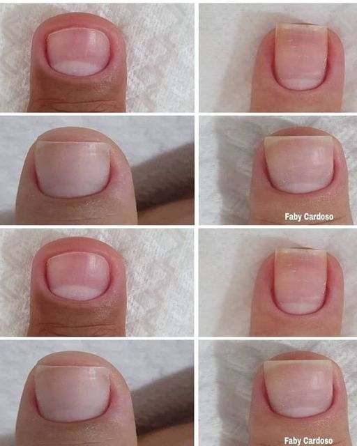 Apple Cider Vinegar Tip to Strengthen and Grow Nails