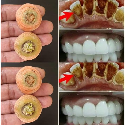 Brighten Your Smile Naturally with Carrot Ends: A Simple Home Remedy for Teeth Whitening