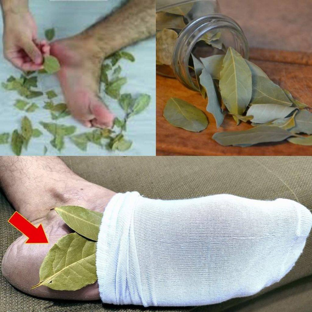 The Surprising Benefits of Bay Leaves for Foot Health