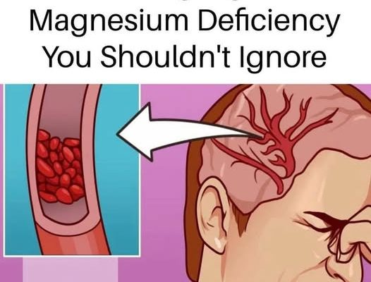 How to Tell If You’re Low on Magnesium & What to Eat Now