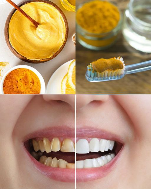 Learn about the natural wonder that turmeric may do for your dental health.Learn about the natural wonder that turmeric may do for your dental health.