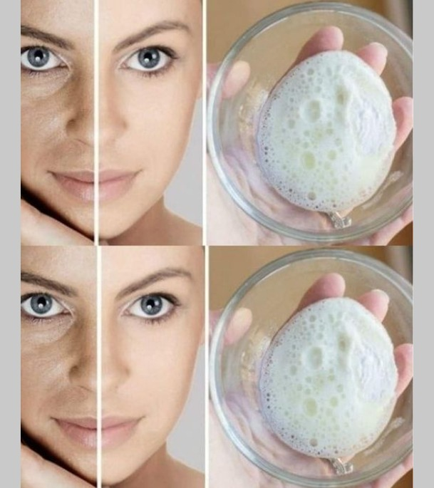 how to make baking soda cream that removes wrinkles skin spots and blackheads